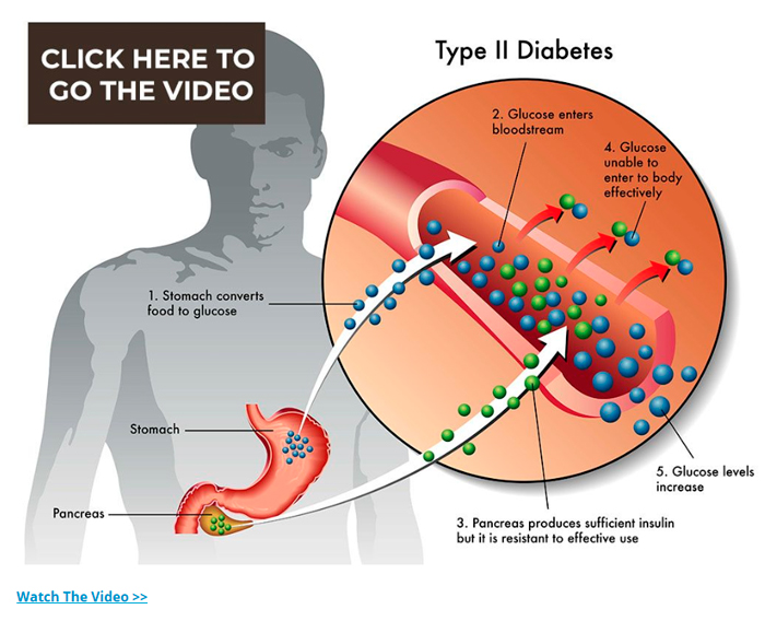 diabetes video